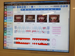 デンタルコミュニケーションソフト